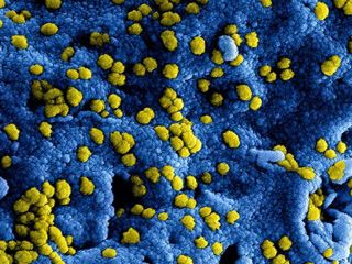 Nieuw Coronavirus In China